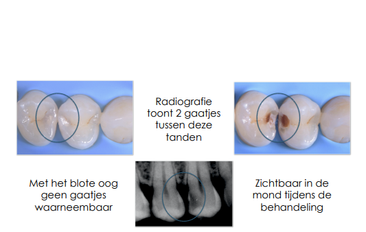 algemene controle desteldent