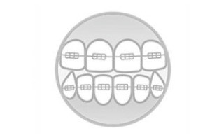 Orthodontie Desteldent